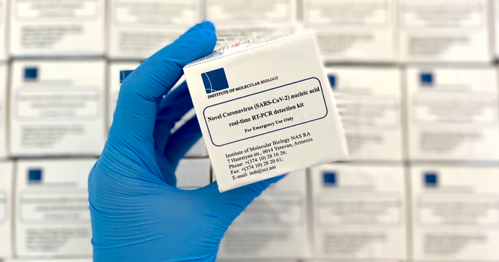 COVID 19 test kits developed by the IMB in Armenia